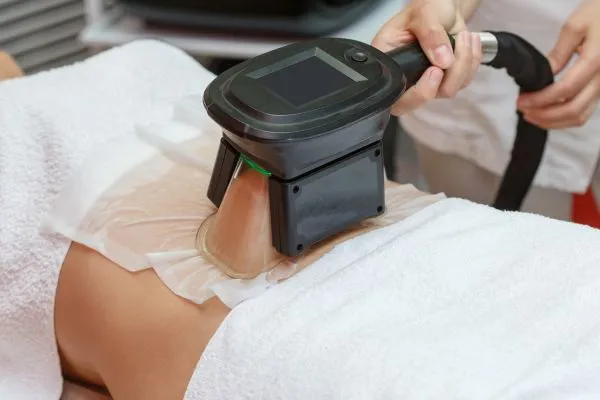 Image of person having fat freezing treatment to help weight gain Soham