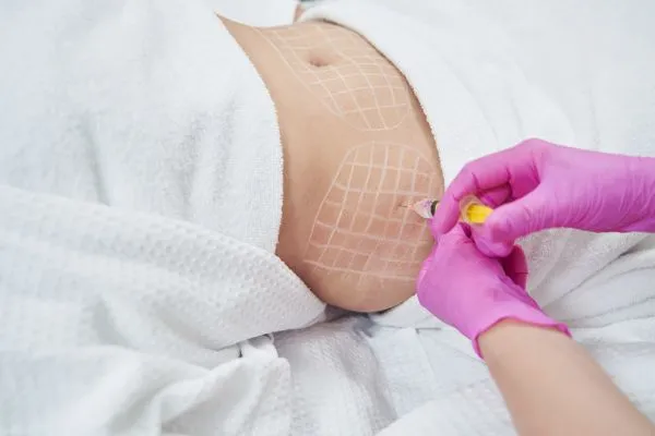 image of fat dissolving injections on love handles to help combat weight gain Soham