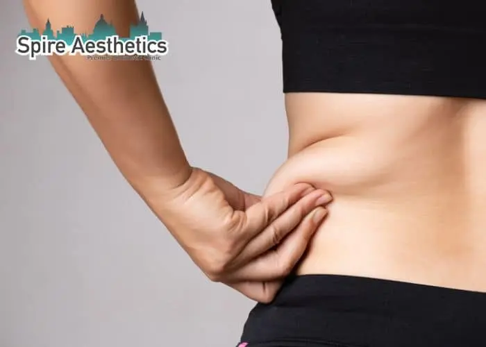 Image of woman pinching fat on their hips Soham. Fat Freezing treatment 
