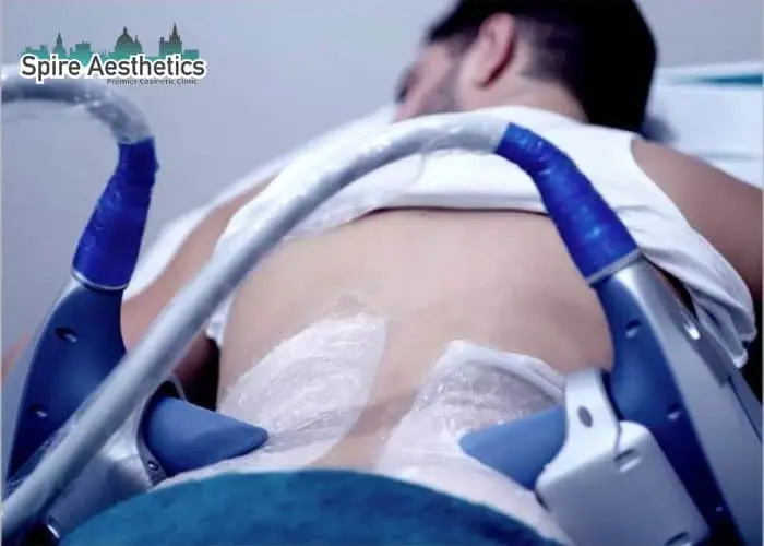 Man having fat freezing treatment done on love handles before a competitions Soham to create a sculpted look.