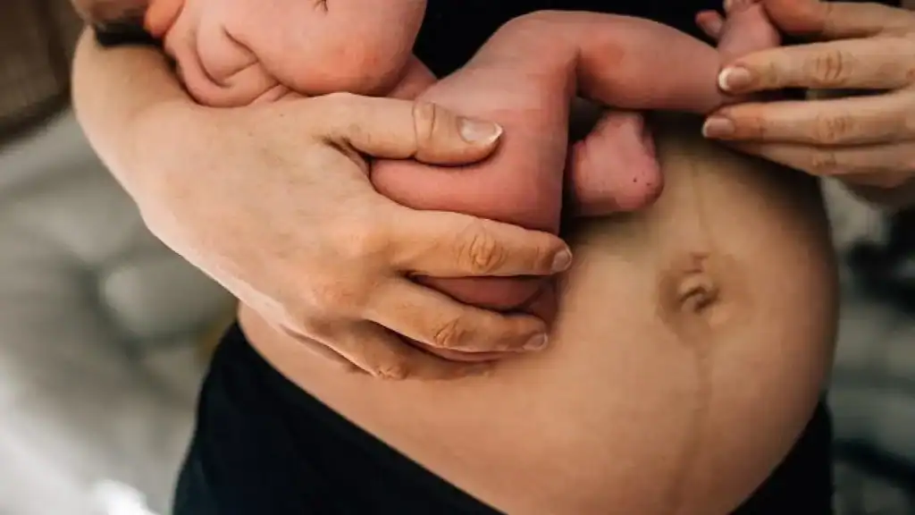 Why Is My Stomach Still Big After Pregnancy Soham?